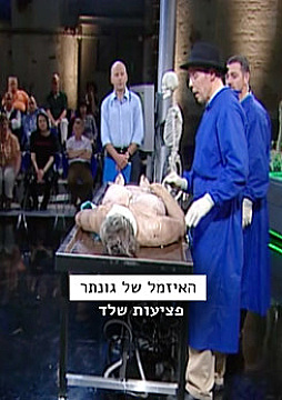 צפייה בסרט המלא - האזמל של גונתר - פציעות שלד